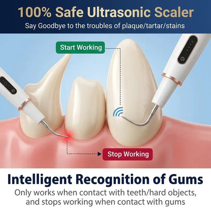 Dogs Tartar Remover, Teeth Cleaning Tool, Electric Ultrasonic